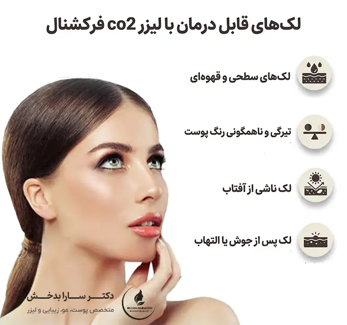 درمان لک صورت با co2 فرکشنال