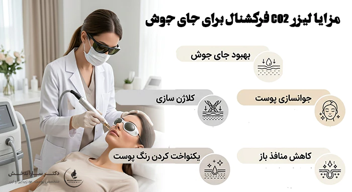 مزایا لیزر CO2 فرکشنال برای جای جوش