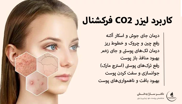 کاربرد لیزر Co2 فرکشنال
