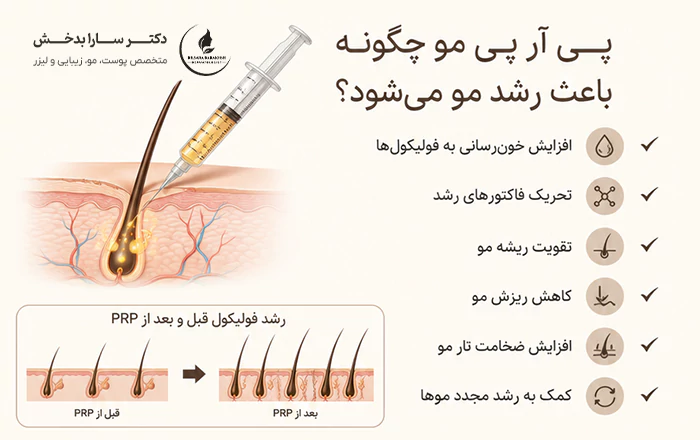 تقویت مو با پی آر پی مو