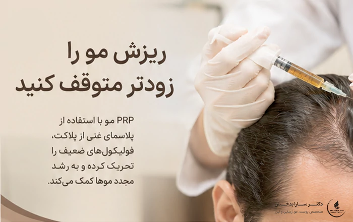درمان ریزش مو با پی آر پی