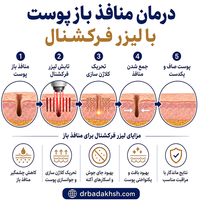 درمان منافذ باز پوست با لیزر فرکشنال