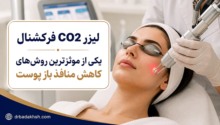 لیزر فرکشنال برای بستن منافذ